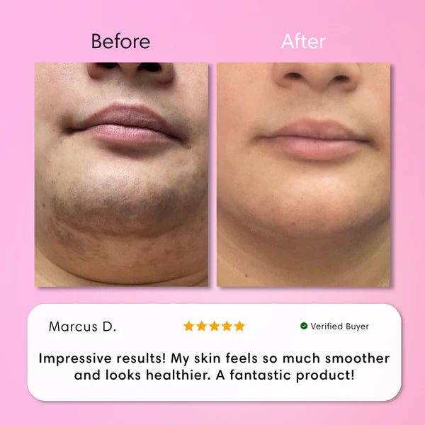 Hair Remover Kit