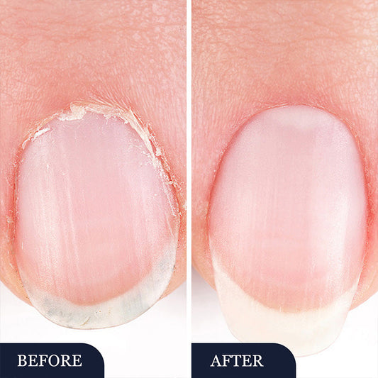 2 In 1 Anti-Fungal Nail Repair Pen